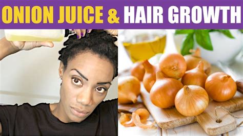 Onion Juice For Hair Regrowth Stop Hair Fall And Thinning Onion