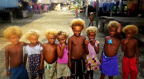Another Genetic Quirk Of The Solomon Islands Blond Hair