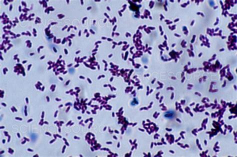 Corynebacterium Diphtheriae Lm Stock Image Science Source Images