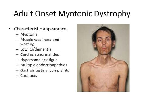 Myotonic Dystrophy Gradually Worsening Muscle Loss And Weakness