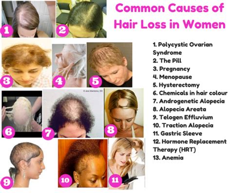 The Cause Of Hair Loss Hair Loss A Widespread Problem