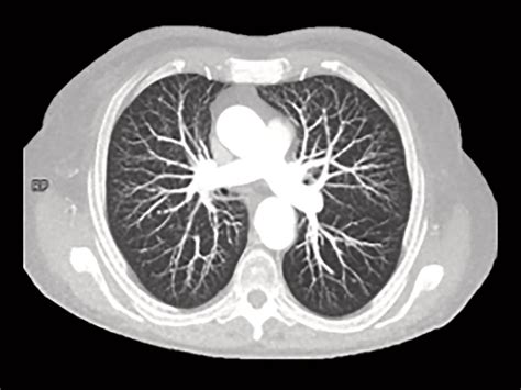 What Is A Ct Scan Computed Tomography Alyeska Imaging