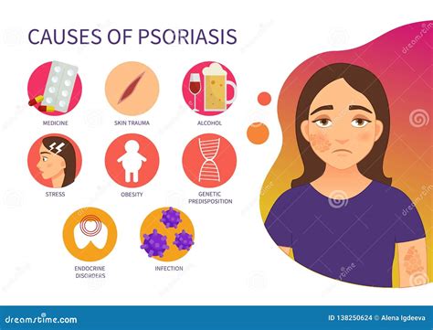 causas del cartel del vector del psoriasis ilustración del vector ilustración de epidermis