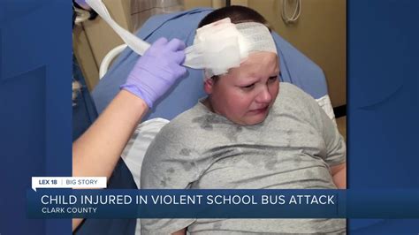 Mom Horrified After Altercation On Clark County School Bus