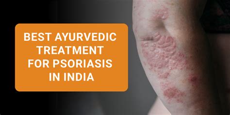 Shuddhi Ayurveda Blog Best Ayurvedic Treatment For Psoriasis In India