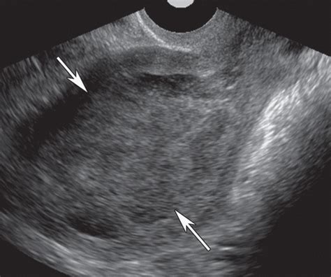 us of the nongravid cervix with multimodality imaging correlation normal appearance pathologic