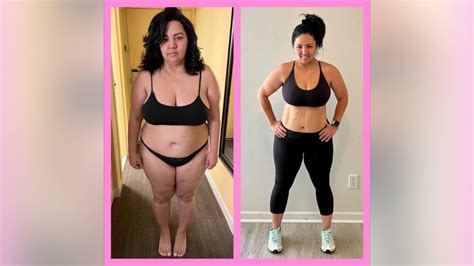 Georgia Stylist Says Incision Free Weight Loss Procedure Helped Her Lose 50 Pounds