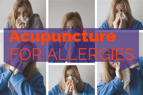 Acupuncture For Allergies Does It Work
