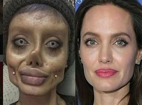 Teens Botched Angelina Jolie Plastic Surgery Roils Internet Proves To