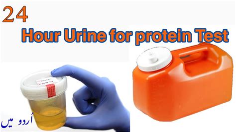 24 Hour Urine Protein Test Purpose Procedure And Results 24 Hour