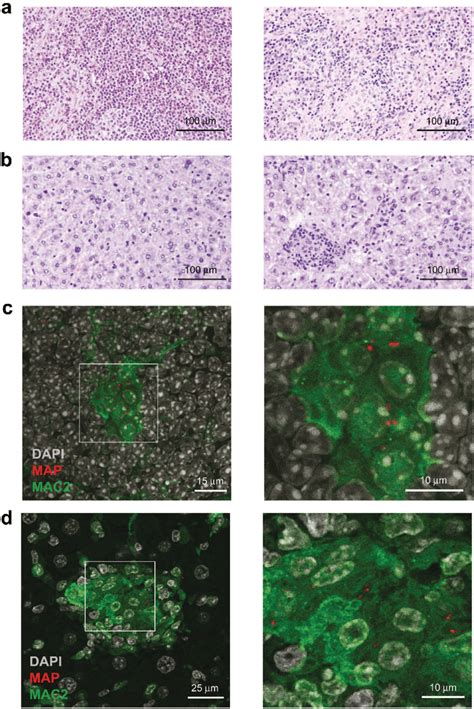 Histopathology Of Spleen And Liver In Map Infected Mice A B He