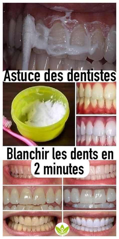 Astuce Des Dentistes Pour Blanchir Les Dents En 2 Minutes Dentist