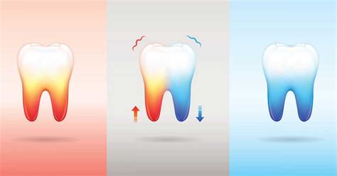 the 101 on your tooth sensitivity jones dental