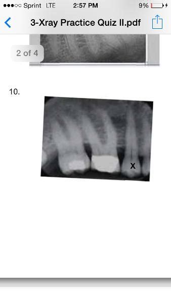 Print Dental Assisting X Ray Quiz 2 Flashcards Easy Notecards