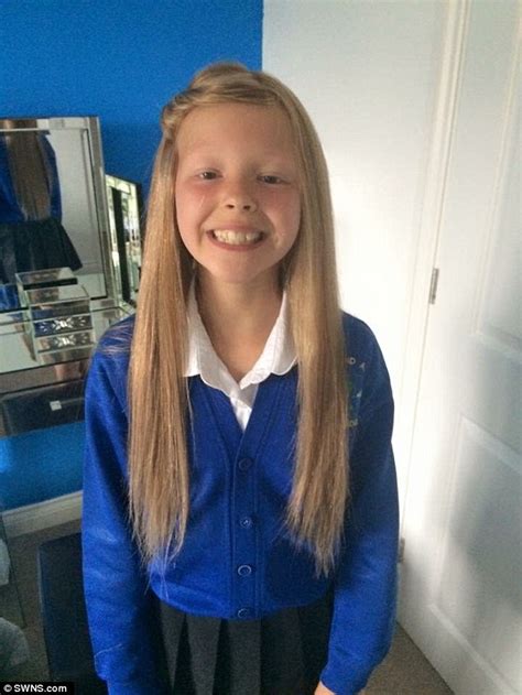 Schoolgirl With Alopecia Develops Scalp Rash After The Nhs Gives Her An Acrylic Wig Daily Mail
