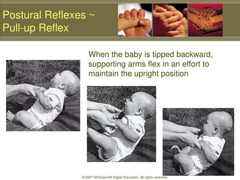 Ppt Infant Reflexes And Stereotypies Powerpoint Presentation Free