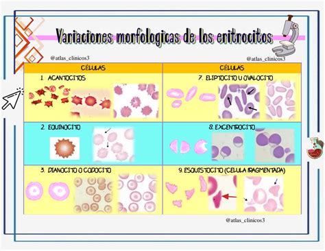 Variaciones Morfológicas De Los Eritrocitos Eritrocitos Hematología