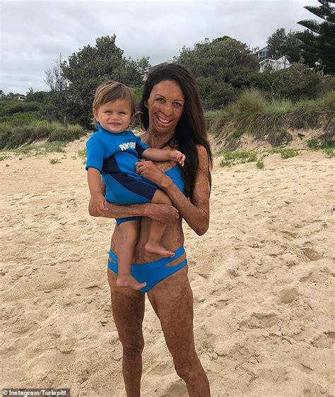 Turia Pitt Reveals That She Was Bullied At A Pool While Training For An Ironman Challenge