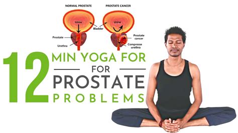 Yoga For Prostate Problems Minutes Yoga With Amit Youtube