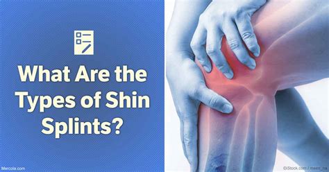 What Are The Types Of Shin Splints