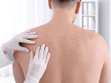 Skin Cancer Screening Skin Cancer Risk Echelon Health