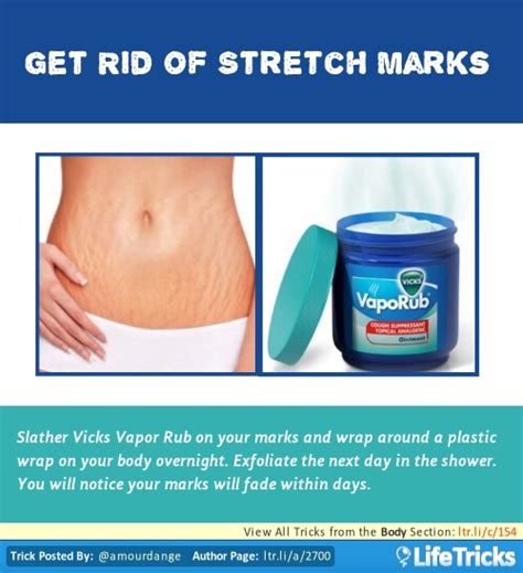 How To Get Rid Of Stretch Marks Musely