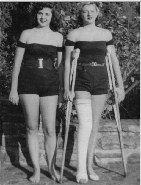 1950s Long Leg Cast Girl A Photo On Flickriver