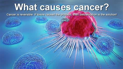 What Causes Cancer The Best Zeolite