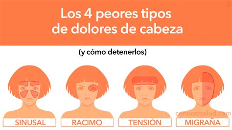 M Dicos Explican Los Peores Tipos De Dolores De Cabeza Y C Mo