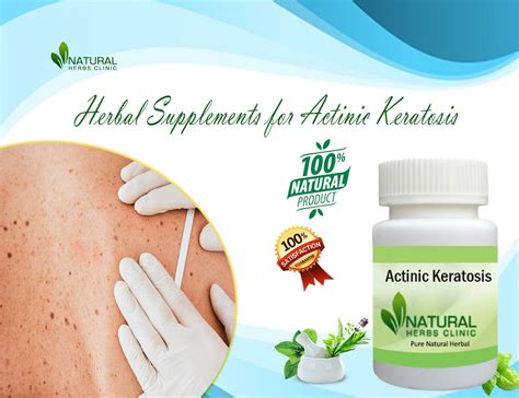 Actinic Keratosis Lets Manage It By Using Herbal Elements