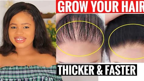 This Is The Best Way To Grow Hair Thicker Longer And Faster Youtube