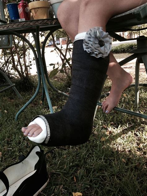 34 Best Fabulous Leg Casts Images On Pinterest Leg Cast Broken Foot