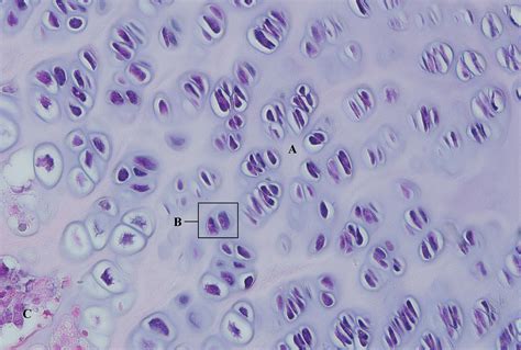 Fibrocartilage Intervertebral Disc