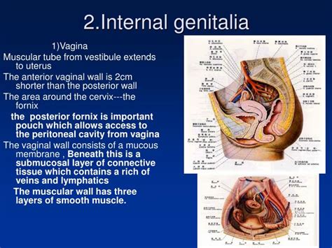 Diagram Of Woman S Groin Area Vulval Intra Epithelial Neoplasia Hot