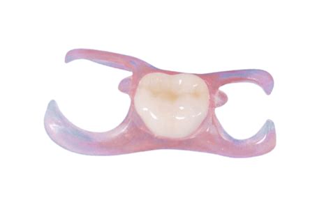 Affordable Tooth Replacement Nesbit Partial Denture