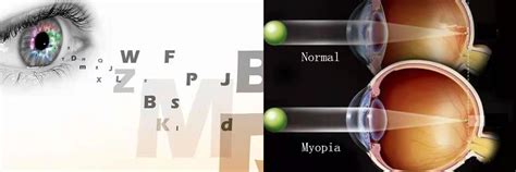 How To Identify Myopia And Pseudomyopia