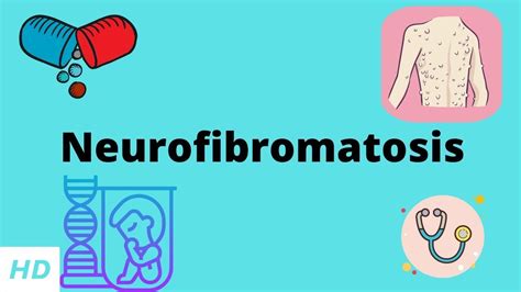 Neurofibromatosis Causes Signs And Symptoms Diagnosis And Treatment