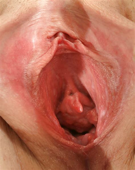 Vagina Holes 11 Pics Xhamster
