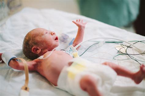 Our Little Monkey Born At 29 Weeks Victoria Premature Baby Photographer