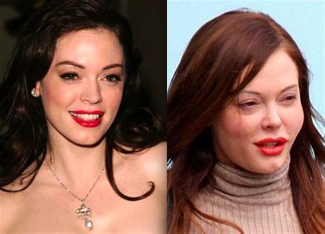 Rose Mcgowan Before And After Plastic Surgery 1 Celebrity Plastic Surgery Online