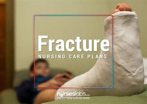 8 Fracture Nursing Care Plans • Nurseslabs