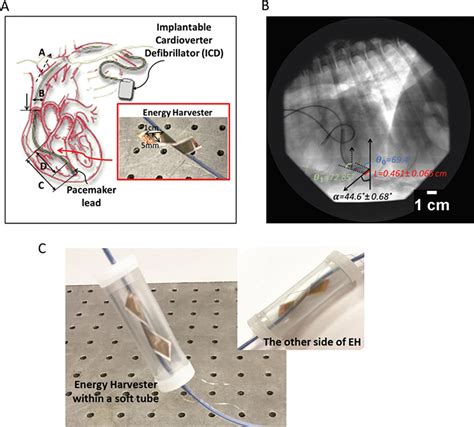 Piezoelectric Cantilever Generates Power For Heart Implant