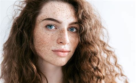 Treating Freckles And Pigmentation Hope Dermatology