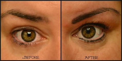 Permanent Eyeliner Before After