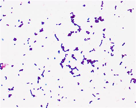 Medical Pictures Gram Stain Stain