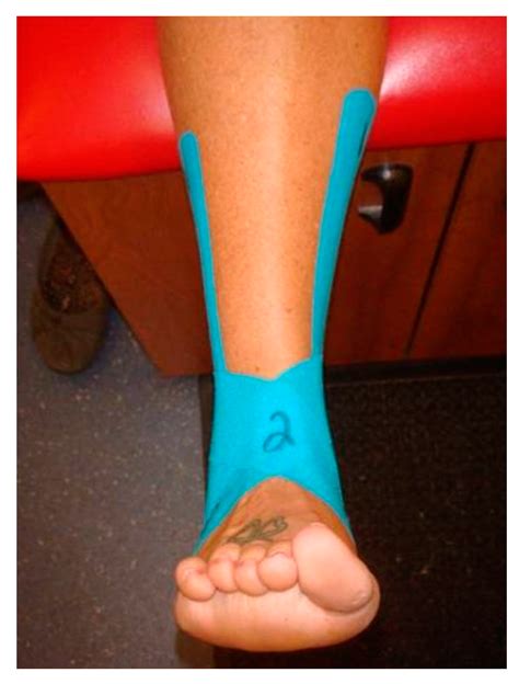 Jfmk Free Full Text Effect Of Kinesio Taping On Ankle Complex