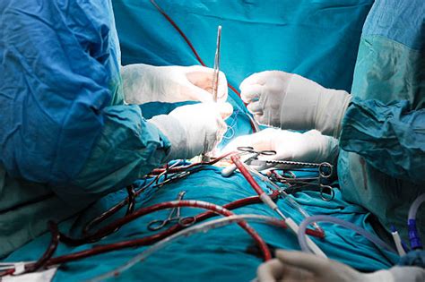 25 Luxury Best Open Heart Surgeon