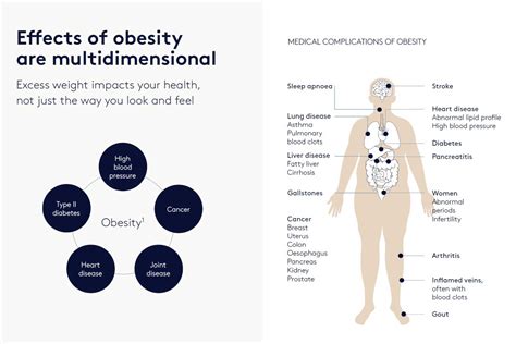 Obesity Health Risk In Malaysia Kitakurang