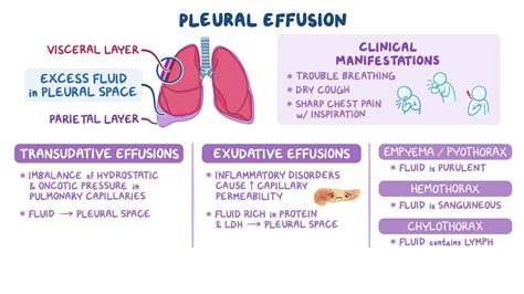 Pleural Effusion Nursing Osmosis Video Library