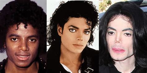 Michael Jackson Plastic Surgery Before After